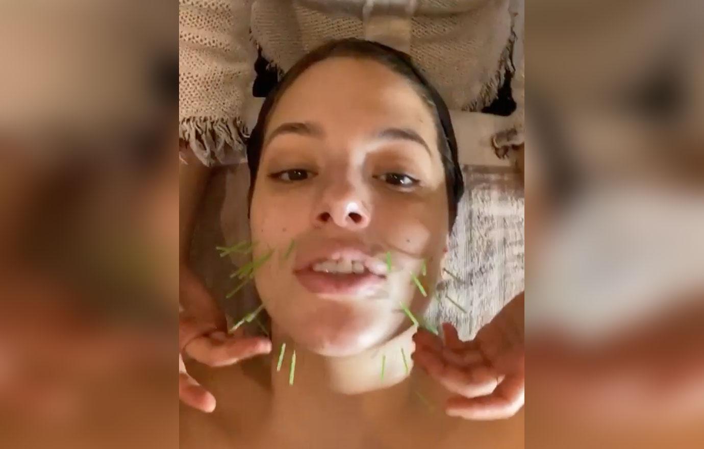 Ashley Graham Gets Facial Acupuncture in New Video