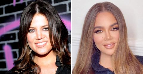 khloe kardashian face transformation plastic surgery experts photo pf
