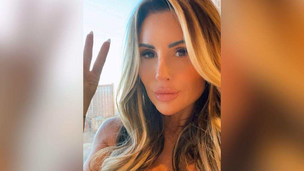 rachel uchitel dramatic facelift transformation before after photos