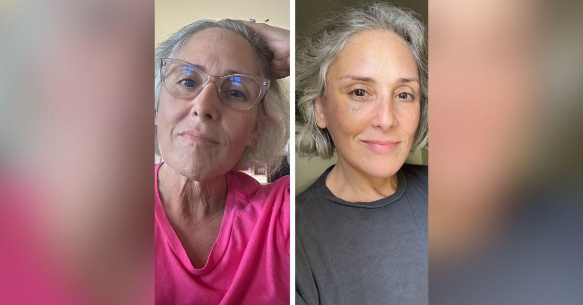 ricki lake reveals before and after results facelift  pound weight loss photos