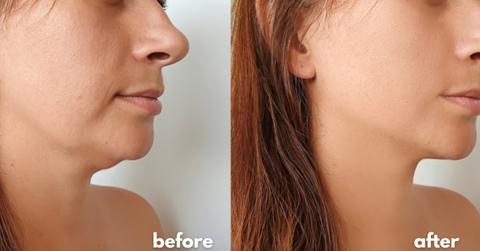 clinical observations and results pp