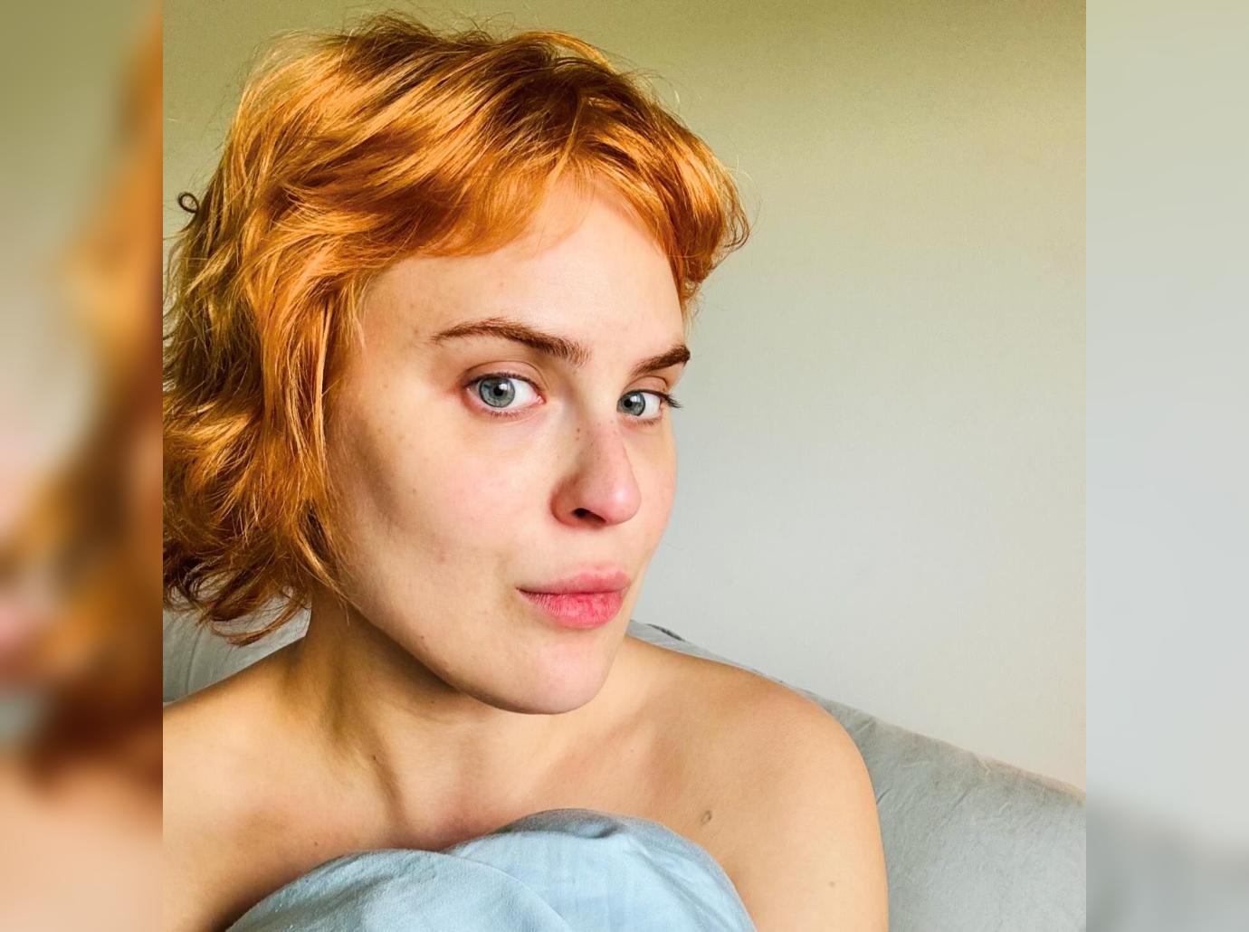 tallulah willis real bone structure face filler disolved photos