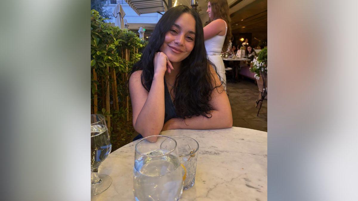 Photo of The star revealed she's been experiencing post-partum hair loss.