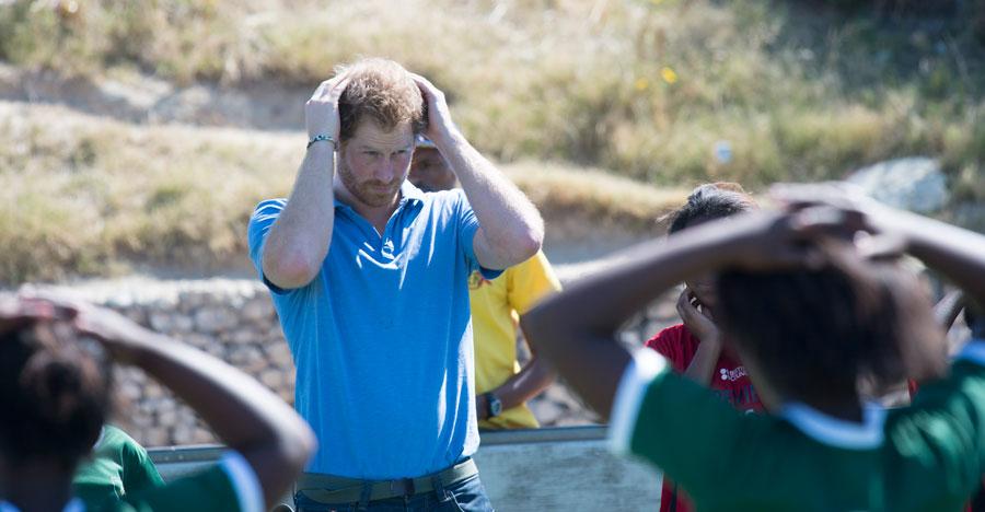 Prince harry going bald hair loss charles william