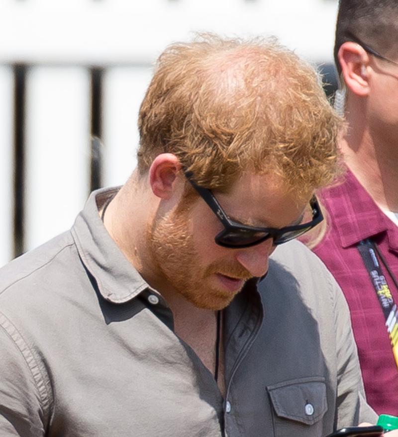 Prince Harry shows his thinning hair as he walks around in the Florida Sunshine at the Invictus Games.