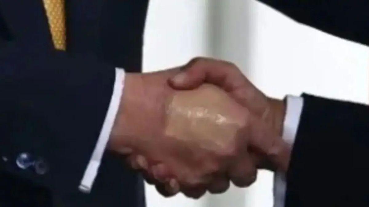 Photo of Donald Trump has been known to use makeup to cover his bruises on his hands. 