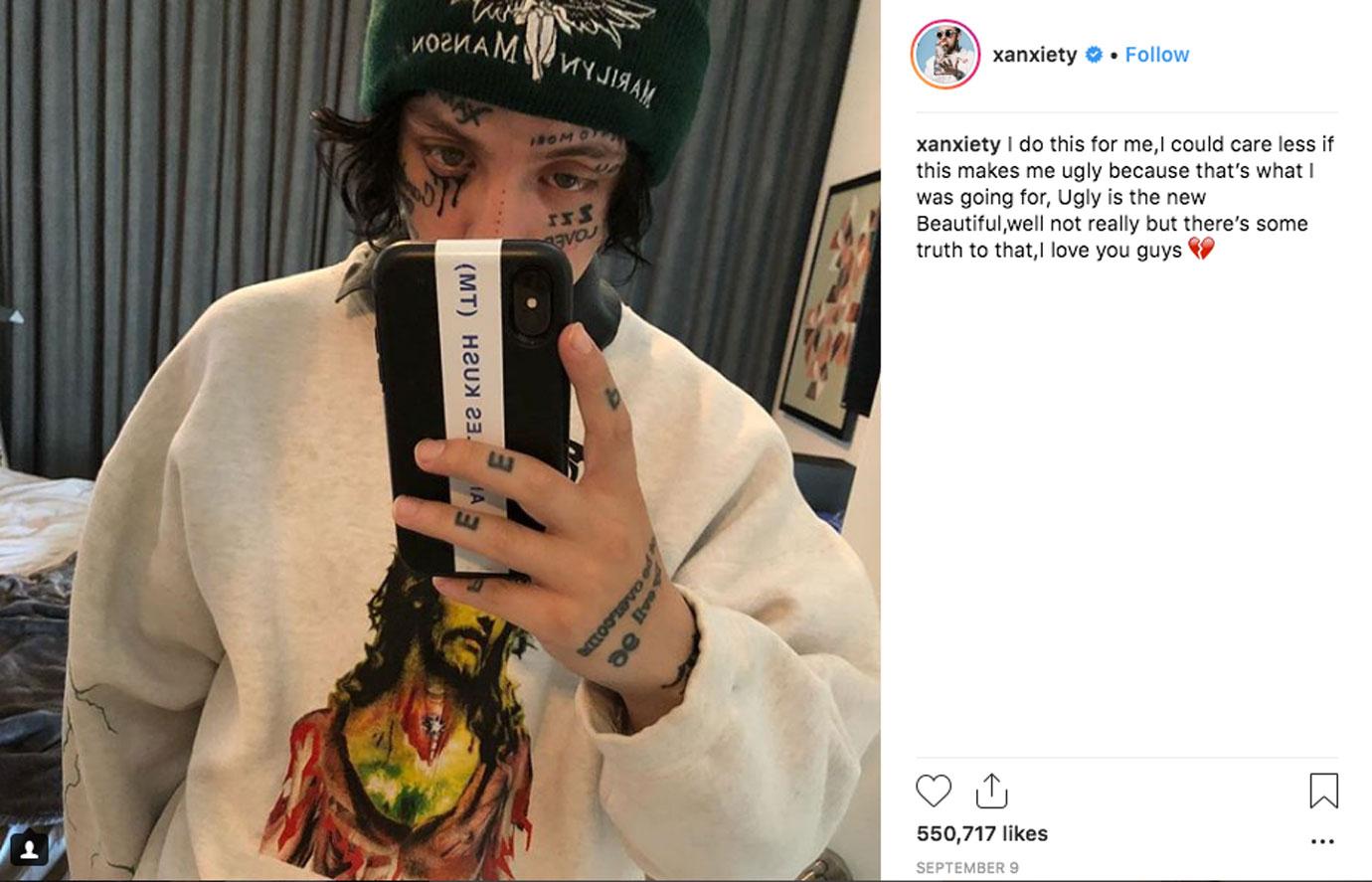 Lil Xan Back Eats Hot Cheetos After Being Hospitalized For Vomiting Blood