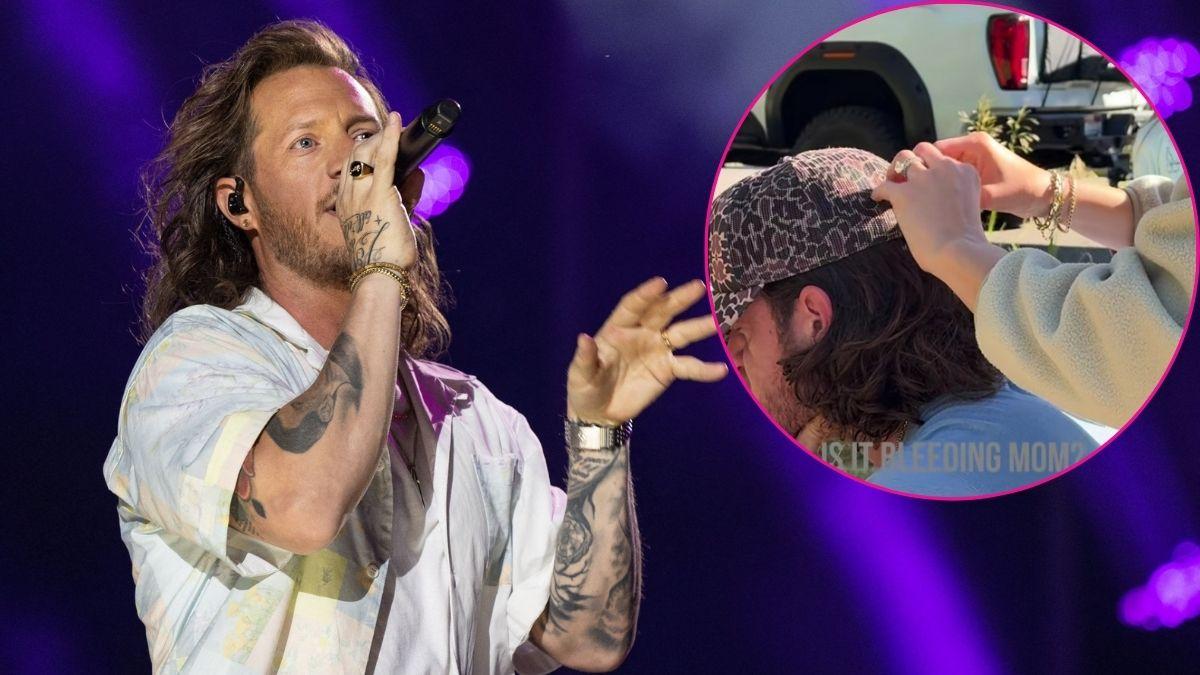 Tyler Hubbard Has Fish Hook Pulled From His Head by Wife Hayley in Wild Camping Mishap
