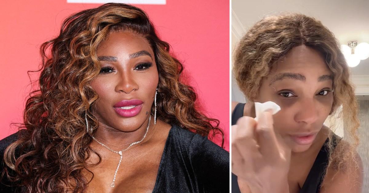 Serena Williams Uses Her Breast Milk To Treat Sunburn: 'It Works!