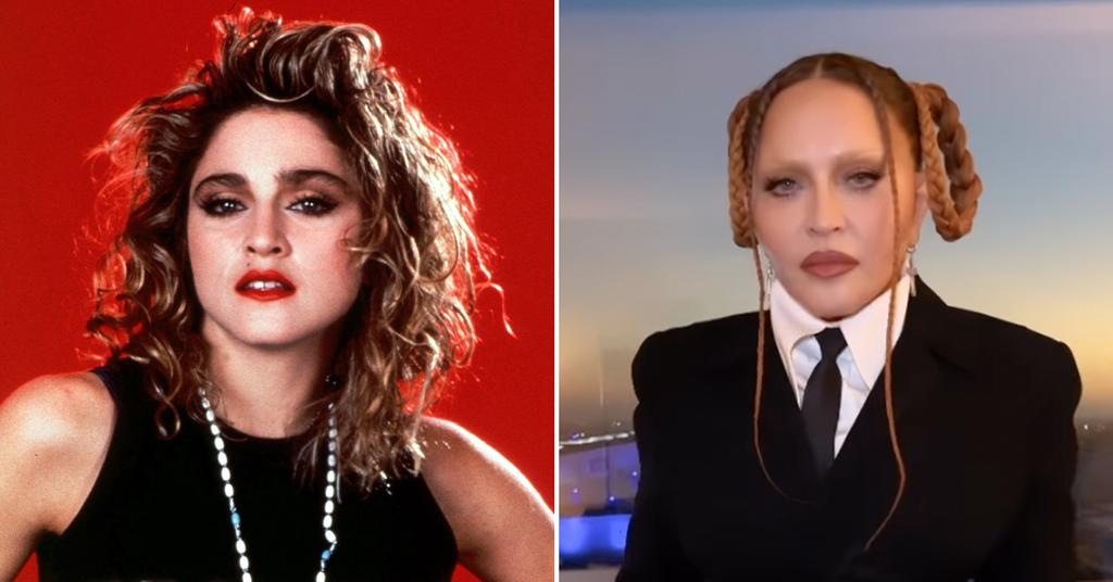Inside Madonna's Facial Transformation Through The Years Photos