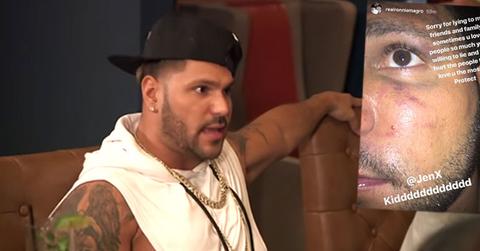 Ronnie ortiz magro black eye pic blames baby mama jen harley pp 1