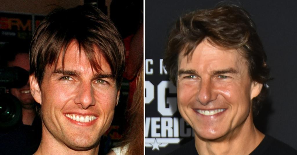 Tom Cruise's Changing Face Sparks Plastic Surgery Buzz Photos