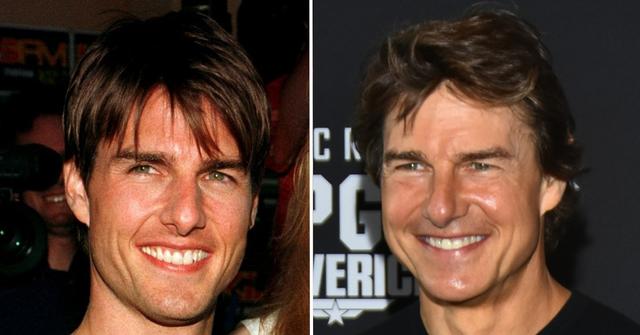 Tom Cruise's Changing Face Sparks Plastic Surgery Buzz: Photos