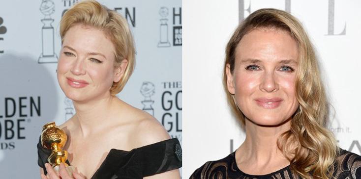 Before after renee zellweger