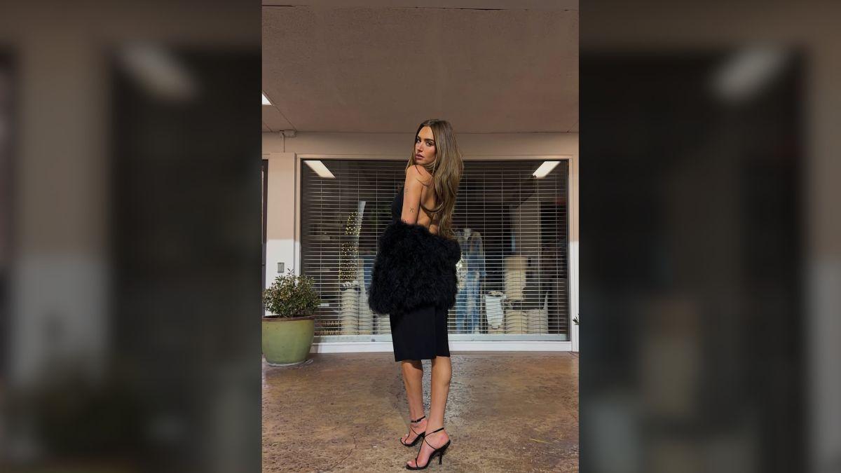 Image of Stassie Karanikolaou vlogged her experience undoing plastic surgery.