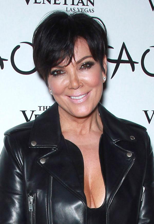 Kris jenner plastic surgery1