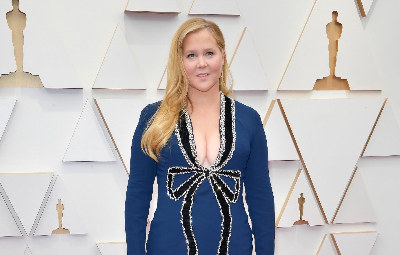 Amy Schumers Nipple Photo Called Out By Orlando Bloom