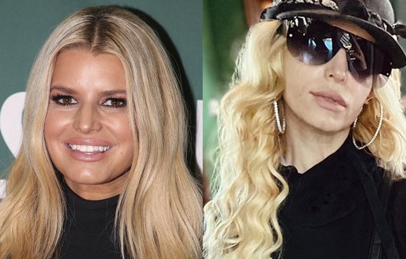 plasticsurgery jessicasimpson