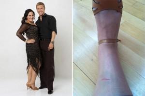 2011__09__Ricki Lake DWTS Injury Sept9newsbt 300&#215;199.jpg