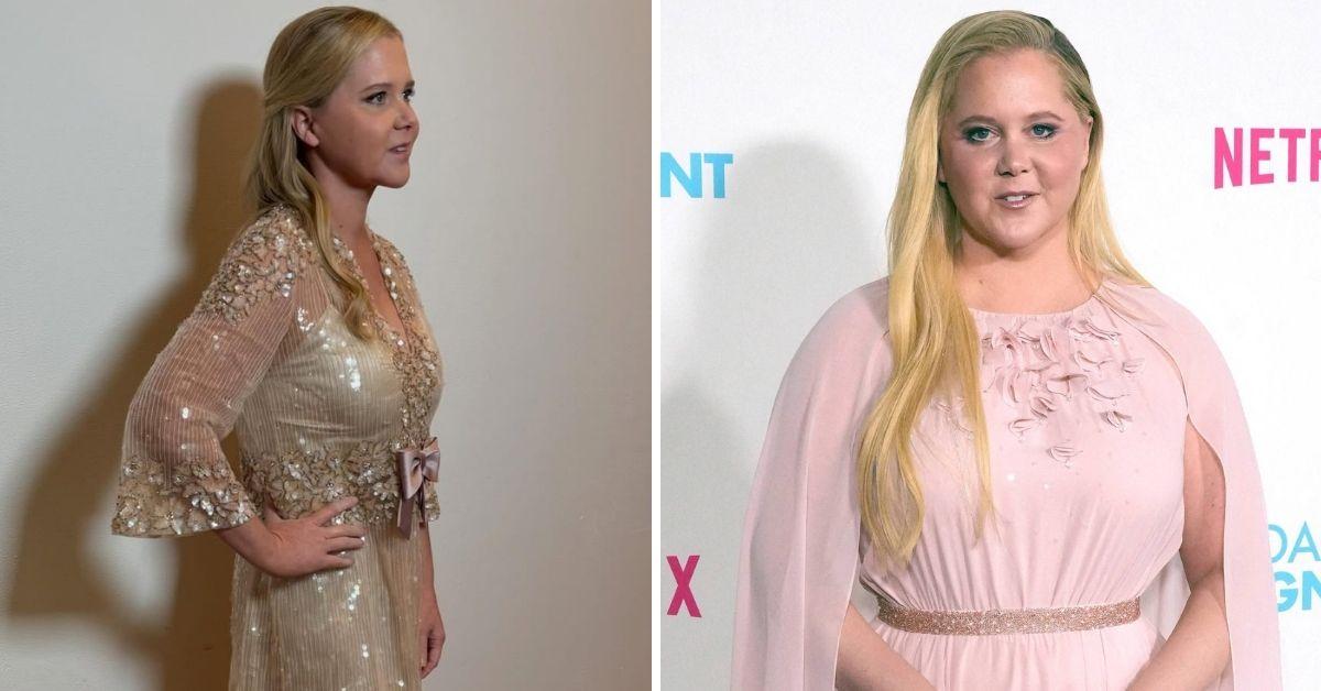 image of Amy Schumer recently split from Chris Fischer.