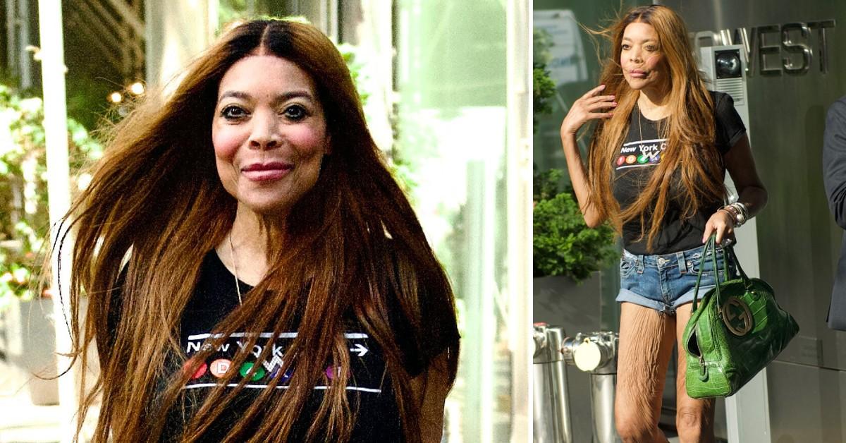 Wendy Williams' Alarming Transformation(02)