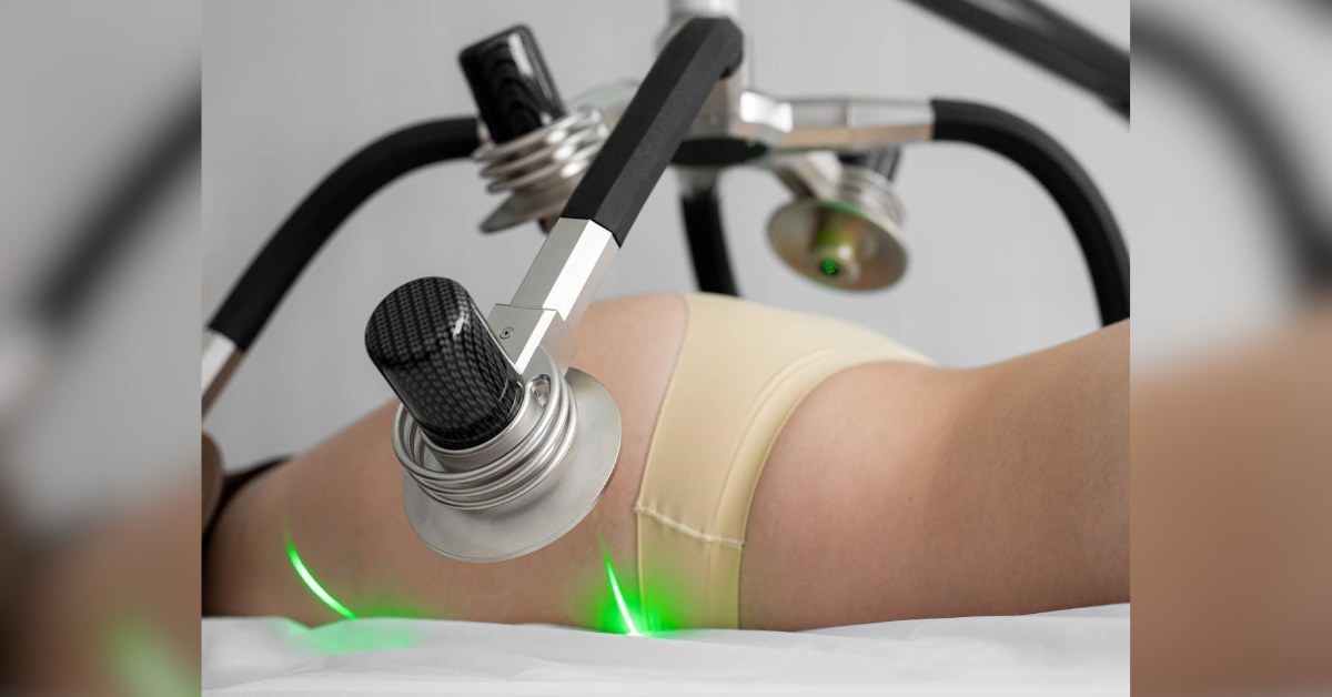 why liposuction is transforming more than just waistlines