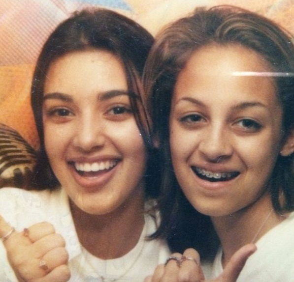 Embarrassing celebrity throwback photos 11