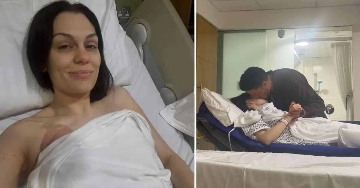 Image of Jessie J underwent a mastectomy at the end of June.