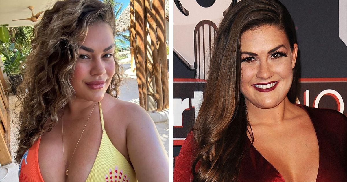 image of The reality star previously underwent a 'mommy makeover.'