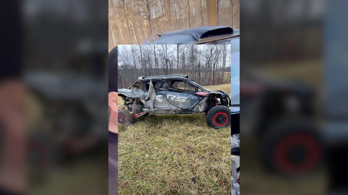 image of Despite the injury, he powered through the 2026 Grammy Awards.