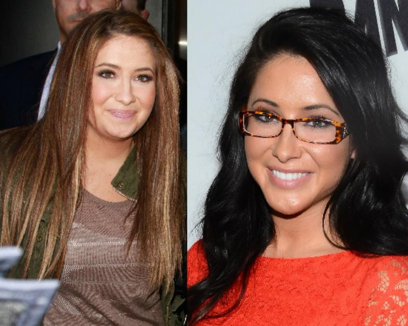 Bristol palin celebrity plastic surgery