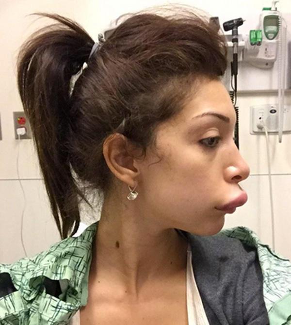 See Ya On Botched Farrah Abraham Shares New Photos Of Her Plastic Surgery Gone Wrong
