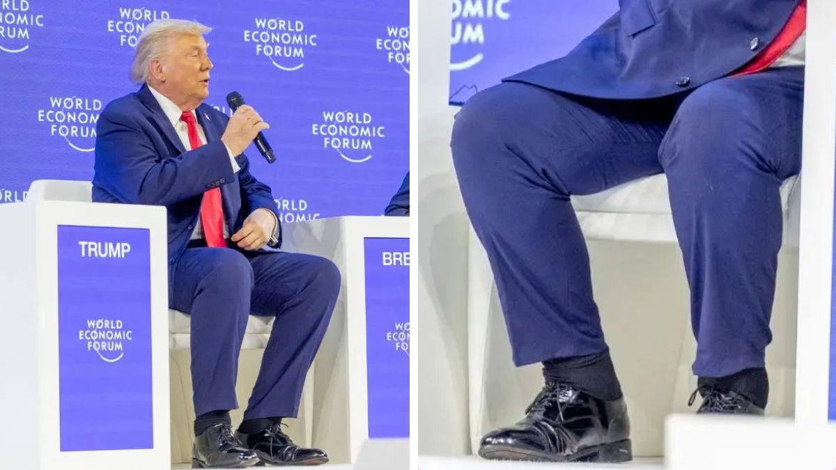 image of Donald Trump's ankles were swollen again at the World Economic Forum.