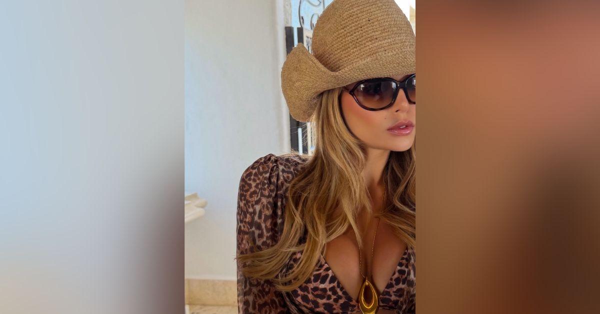 Image of Brooks Nader recently got her lip filler dissolved.