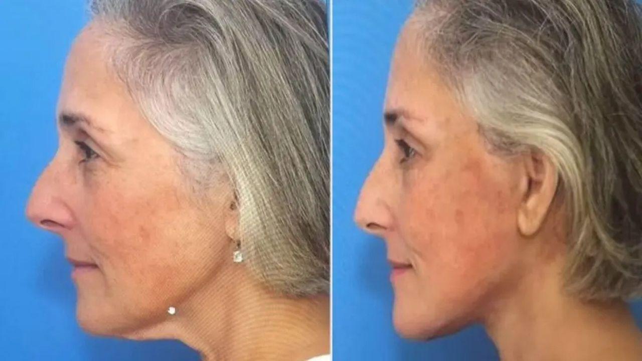 ricki lake plastic surgery transformation before after photos
