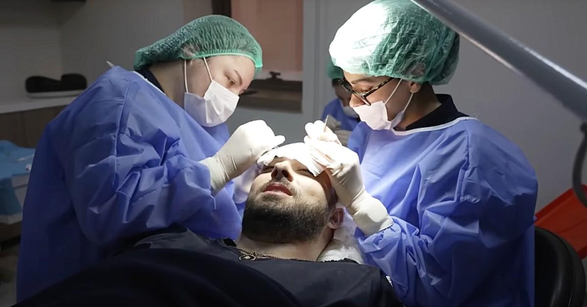 baldstool nicky smokes surgery