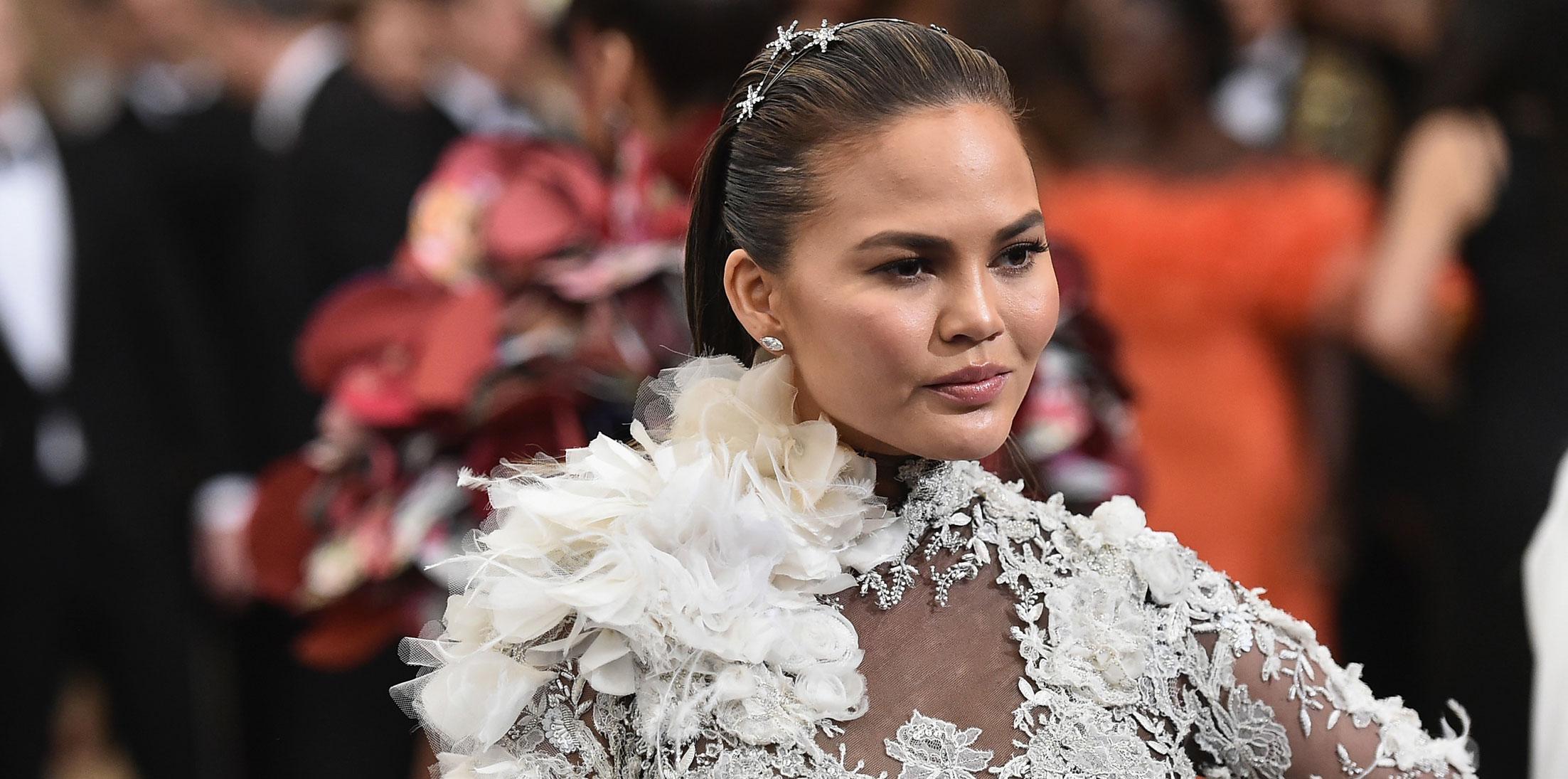 Chrissy teigen joking plastic surgery face 1