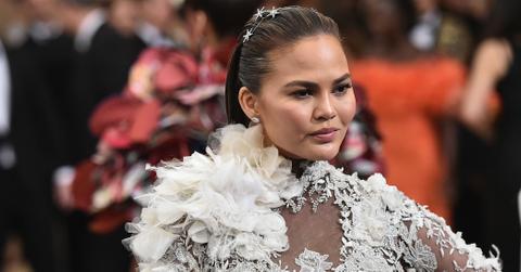 Chrissy teigen joking plastic surgery face 1