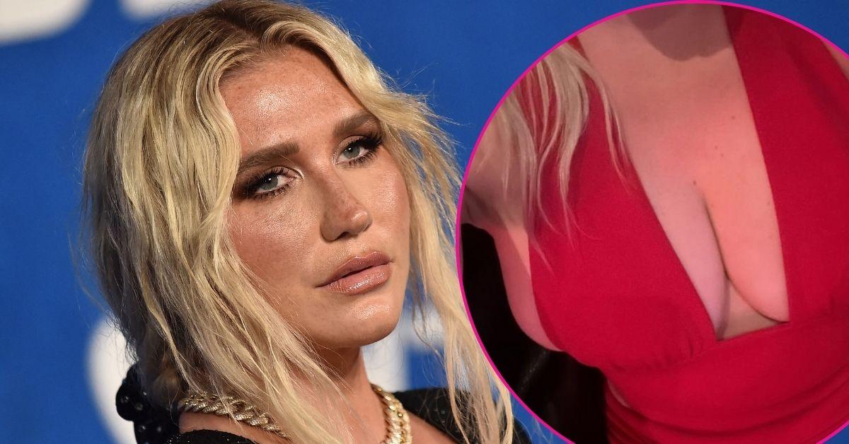 split image of Kesha and Kesha's chest in a red dress