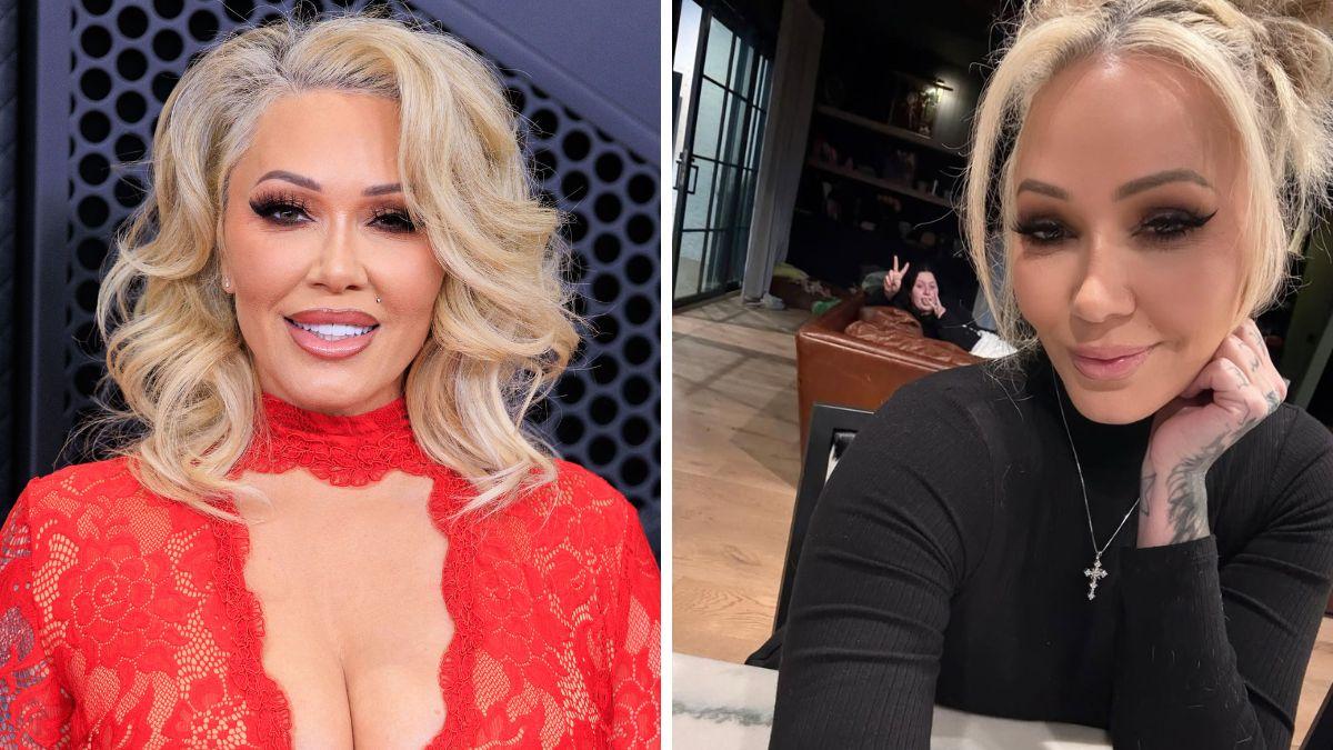 celebrities who got facelifts before after photos
