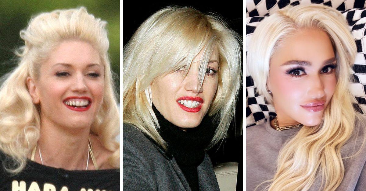 Gwen Stefani's Transformation: Did The Singer Get Plastic Surgery?