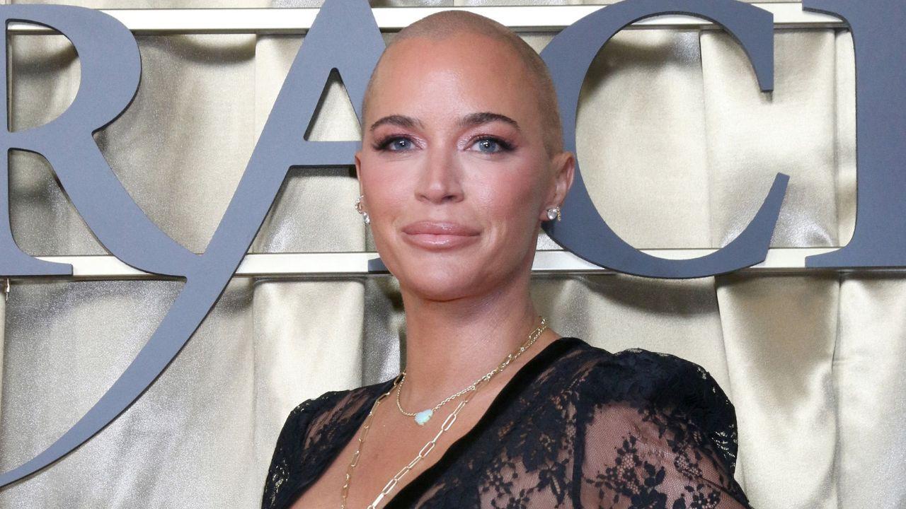 Image of Teddi Mellencamp continued immunotherapy as she recovered from her upper eyelid surgery.