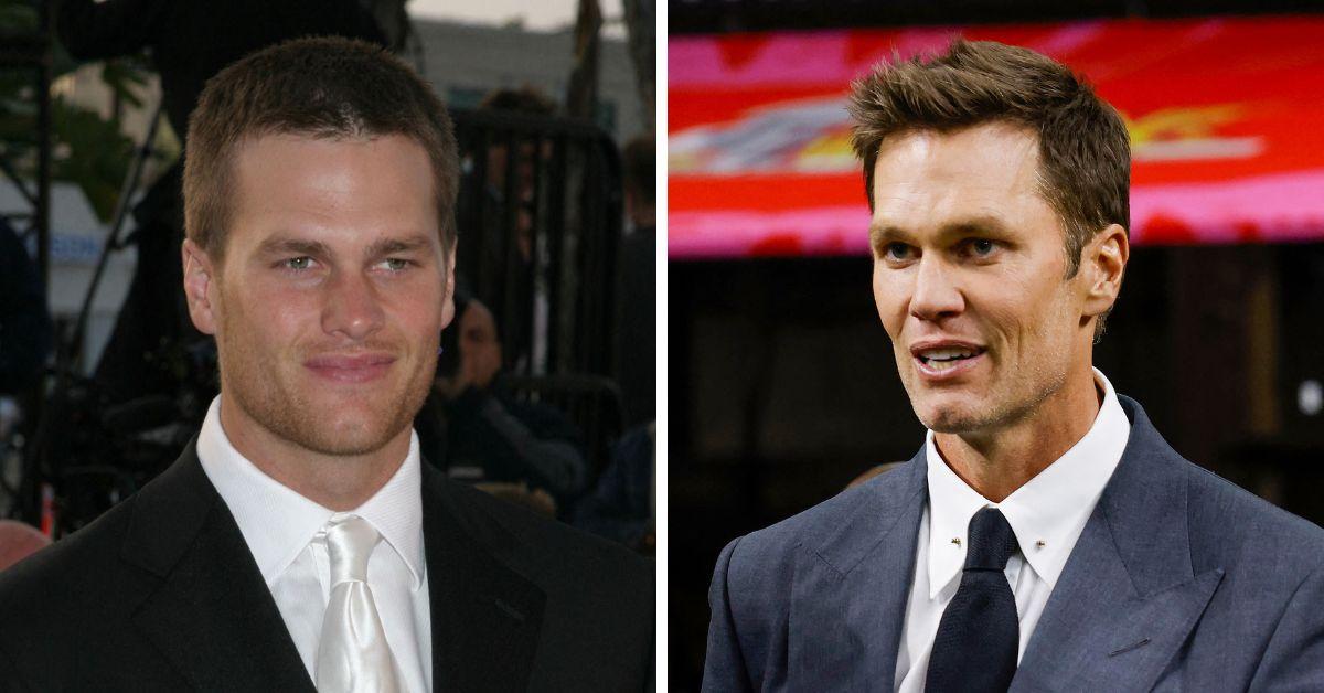 tom brady plastic surgery rumors transformation timeline