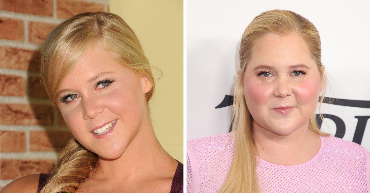 amy schumer