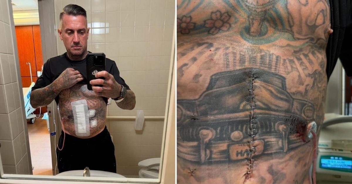 pinks husband carey hart graphic surgery suffering injuries motocross crash photos
