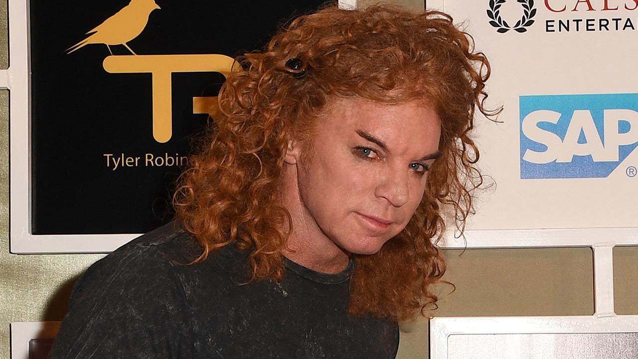 Image of Zachary DeFazio claimed intimidation contributed to his delay in reporting the alleged incidents that he claims happened with Carrot Top.