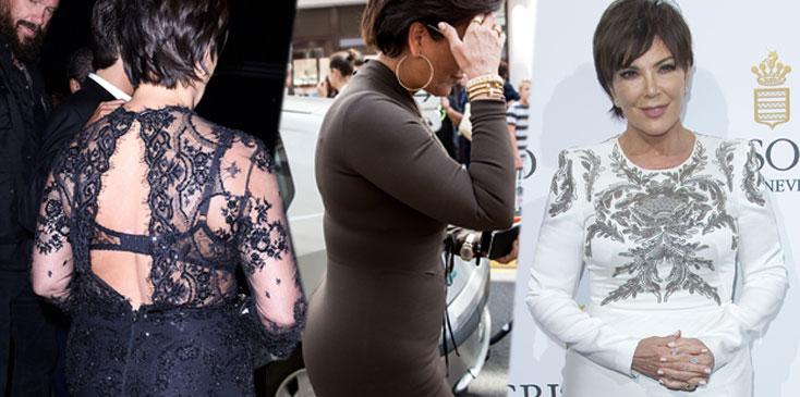 kris jenner weight gain lipo surgery