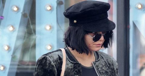 Vanessa hudgens acne