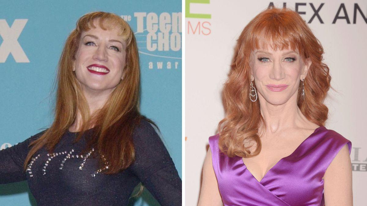 celebrities who got facelifts before after photos