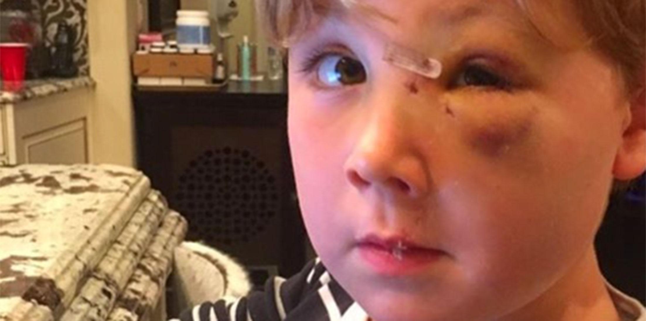 Kim zolciak son attacked by dog photos